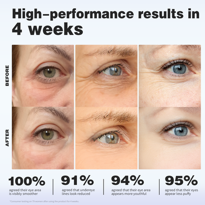 Instant Awake Eye Spa Set